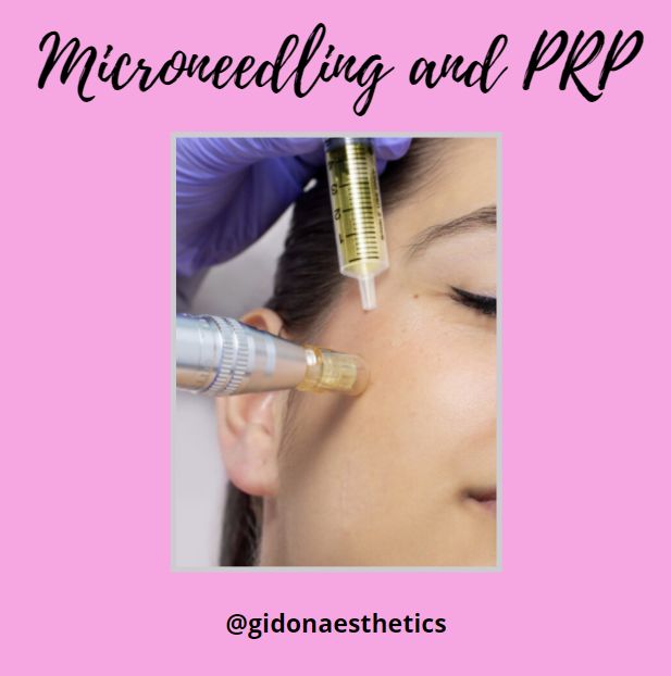 Microneedling