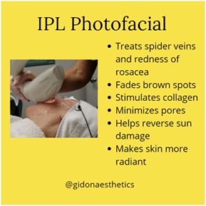 IPL Photofacial